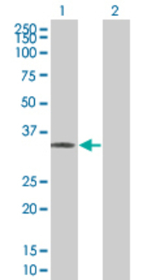 Lane 1: POMC transfected lysate (29.48 KDa) Lane 2: Non-transfected lysate.