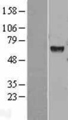 Western Blot: HEXA Overexpression Lysate (Adult Normal) [NBL1-11515] Left-Empty vector transfected control cell lysate (HEK293 cell lysate); Right -Over-expression Lysate for HEXA.