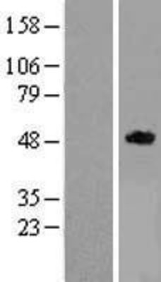 Western Blot: RELT Overexpression Lysate (Adult Normal) [NBP2-09936] Left-Empty vector transfected control cell lysate (HEK293 cell lysate); Right -Over-expression Lysate for RELT.