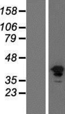 Western Blot: FGFR1 Overexpression Lysate (Adult Normal) [NBP2-09911] Left-Empty vector transfected control cell lysate (HEK293 cell lysate); Right -Over-expression Lysate for FGFR1.
