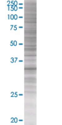 TP53I3 transfected lysate.