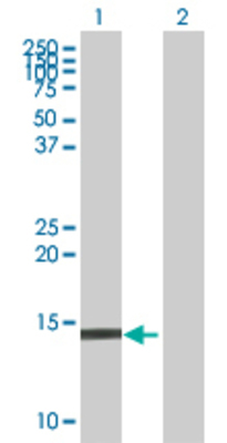 Lane 1: G1P2 transfected lysate (17.9 KDa) Lane 2: Non-transfected lysate.