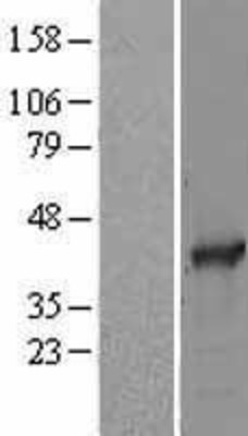 Western Blot: SAE1 Overexpression Lysate (Adult Normal) [NBP2-09877] Left-Empty vector transfected control cell lysate (HEK293 cell lysate); Right -Over-expression Lysate for SAE1.