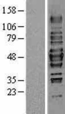 Western Blot: HDAC3 Overexpression Lysate (Adult Normal) [NBL1-11481] Left-Empty vector transfected control cell lysate (HEK293 cell lysate); Right -Over-expression Lysate for HDAC3.