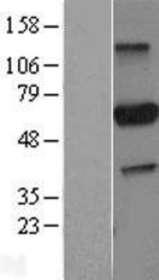 Western Blot: PARP3 Overexpression Lysate (Adult Normal) [NBL1-14116] Left-Empty vector transfected control cell lysate (HEK293 cell lysate); Right -Over-expression Lysate for PARP3.