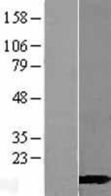 Western Blot: CALML3 Overexpression Lysate (Adult Normal) [NBL1-08652] Left-Empty vector transfected control cell lysate (HEK293 cell lysate); Right -Over-expression Lysate for CALML3.