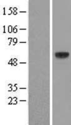 Western Blot: FUT11 Overexpression Lysate (Adult Normal) [NBL1-10864] Left-Empty vector transfected control cell lysate (HEK293 cell lysate); Right -Over-expression Lysate for FUT11.