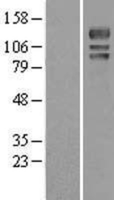 Western Blot: USP4 Overexpression Lysate (Adult Normal) [NBL1-17663] Left-Empty vector transfected control cell lysate (HEK293 cell lysate); Right -Over-expression Lysate for USP4.