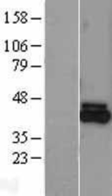 Western Blot: FECH Overexpression Lysate (Adult Normal) [NBL1-10673] Left-Empty vector transfected control cell lysate (HEK293 cell lysate); Right -Over-expression Lysate for FECH.