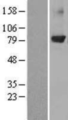 Western Blot: PKC beta Overexpression Lysate (Adult Normal) [NBL1-14770] Left-Empty vector transfected control cell lysate (HEK293 cell lysate); Right -Over-expression Lysate for PKC beta.
