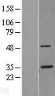 Western Blot: SUG1 Overexpression Lysate (Adult Normal) [NBL1-14892] Left-Empty vector transfected control cell lysate (HEK293 cell lysate); Right -Over-expression Lysate for SUG1.