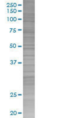 KCNIP2 transfected lysate.