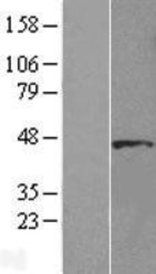 Western Blot: DYX1C1 Overexpression Lysate (Adult Normal) [NBL1-10080] Left-Empty vector transfected control cell lysate (HEK293 cell lysate); Right -Over-expression Lysate for DYX1C1.