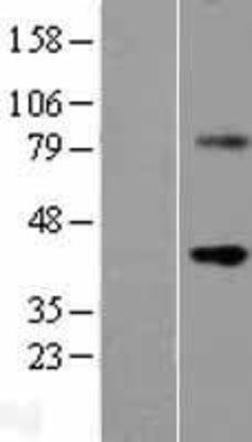 Western Blot: WNT9B Overexpression Lysate (Adult Normal) [NBL1-17881] Left-Empty vector transfected control cell lysate (HEK293 cell lysate); Right -Over-expression Lysate for WNT9B.