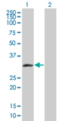Lane 1: KCNIP2 transfected lysate (29.81 KDa) Lane 2: Non-transfected lysate.
