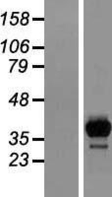 Western Blot: HPCL Overexpression Lysate (Adult Normal) [NBL1-11434] Left-Empty vector transfected control cell lysate (HEK293 cell lysate); Right -Over-expression Lysate for HPCL.