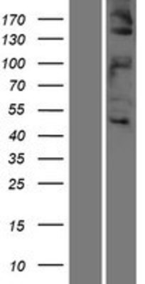 Western Blot: Met (c-Met) Overexpression Lysate (Adult Normal) [NBL1-13017] Left-Empty vector transfected control cell lysate (HEK293 cell lysate); Right -Over-expression Lysate for Met (c-Met).