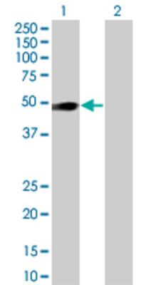 Lane 1: OSMR transfected lysate (39.5 KDa) Lane 2: Non-transfected lysate.