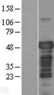 Western Blot: Tau Overexpression Lysate (Adult Normal) [NBL1-12895] Left-Empty vector transfected control cell lysate (HEK293 cell lysate); Right -Over-expression Lysate for Tau.