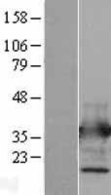 Western Blot: Annexin V Overexpression Lysate (Adult Normal) [NBL1-07565] Left-Empty vector transfected control cell lysate (HEK293 cell lysate); Right -Over-expression Lysate for Annexin V.