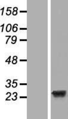 Western Blot: EFCAB1 Overexpression Lysate (Adult Normal) [NBL1-10129] Left-Empty vector transfected control cell lysate (HEK293 cell lysate); Right -Over-expression Lysate for EFCAB1.