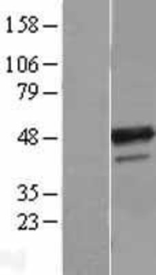 Western Blot: B4GALT3 Overexpression Lysate (Adult Normal) [NBL1-07889] Left-Empty vector transfected control cell lysate (HEK293 cell lysate); Right -Over-expression Lysate for B4GALT3.