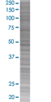 OSMR transfected lysate.