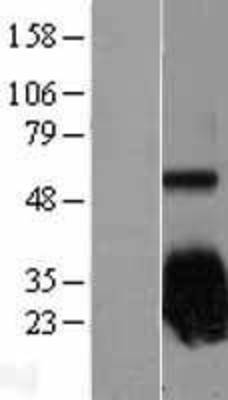Western Blot: Superoxide Dismutase 2 Overexpression Lysate (Adult Normal) [NBL1-16333] Left-Empty vector transfected control cell lysate (HEK293 cell lysate); Right -Over-expression Lysate for Superoxide Dismutase 2.
