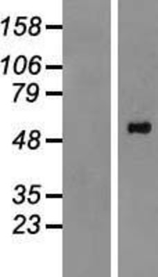 Western Blot: PPM1H Overexpression Lysate (Adult Normal) [NBP2-06626] Left-Empty vector transfected control cell lysate (HEK293 cell lysate); Right -Over-expression Lysate for PPM1H.
