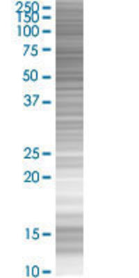 GTF3C5 transfected lysate.
