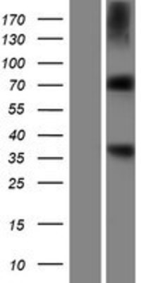 Western Blot: RNPEP Overexpression Lysate (Adult Normal) [NBP2-06674] Left-Empty vector transfected control cell lysate (HEK293 cell lysate); Right -Over-expression Lysate for RNPEP.