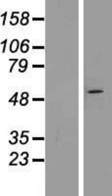 Western Blot: ZNF654 Overexpression Lysate (Adult Normal) [NBP2-06823] Left-Empty vector transfected control cell lysate (HEK293 cell lysate); Right -Over-expression Lysate for ZNF654.