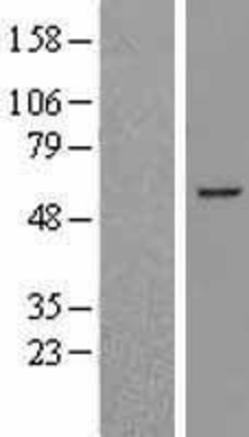 Western Blot: BCL6B Overexpression Lysate (Adult Normal) [NBL1-07952] Left-Empty vector transfected control cell lysate (HEK293 cell lysate); Right -Over-expression Lysate for BCL6B.