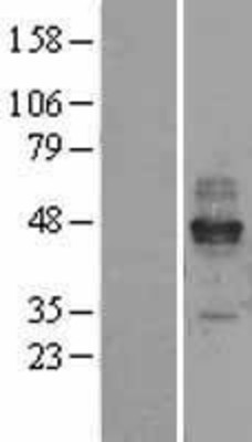 Western Blot: Fc epsilon RI Overexpression Lysate (Adult Normal) [NBL1-10650] Left-Empty vector transfected control cell lysate (HEK293 cell lysate); Right -Over-expression Lysate for Fc epsilon RI.