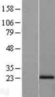 Western Blot: N acetyl transferase 5 Overexpression Lysate (Adult Normal) [NBL1-13489] Left-Empty vector transfected control cell lysate (HEK293 cell lysate); Right -Over-expression Lysate for N acetyl transferase 5.