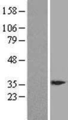 Western Blot: DSCR3 Overexpression Lysate (Adult Normal) [NBL1-10024] Left-Empty vector transfected control cell lysate (HEK293 cell lysate); Right -Over-expression Lysate for DSCR3.