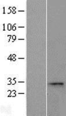 Western Blot: CCDC28A Overexpression Lysate (Adult Normal) [NBL1-08790] Left-Empty vector transfected control cell lysate (HEK293 cell lysate); Right -Over-expression Lysate for CCDC28A.