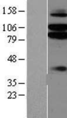 Western Blot: Netrin G1 ligand Overexpression Lysate (Adult Normal) [NBP2-06594] Left-Empty vector transfected control cell lysate (HEK293 cell lysate); Right -Over-expression Lysate for Netrin G1 ligand.