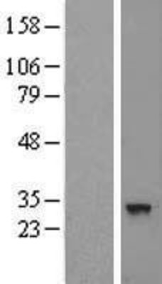 Western Blot: CNOT8 Overexpression Lysate (Adult Normal) [NBL1-09321] Left-Empty vector transfected control cell lysate (HEK293 cell lysate); Right -Over-expression Lysate for CNOT8.