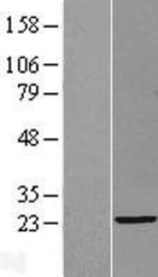 Western Blot: HSD5 Overexpression Lysate (Adult Normal) [NBL1-08444] Left-Empty vector transfected control cell lysate (HEK293 cell lysate); Right -Over-expression Lysate for HSD5.