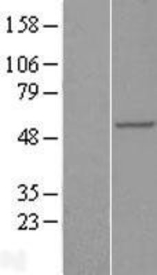 Western Blot: RAB3IP Overexpression Lysate (Adult Normal) [NBP2-06434] Left-Empty vector transfected control cell lysate (HEK293 cell lysate); Right -Over-expression Lysate for RAB3IP.