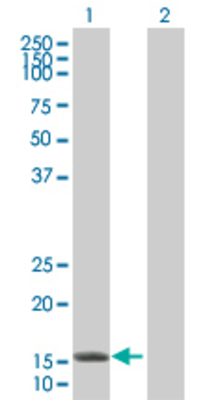 Lane 1: FABP5 transfected lysate (15.2 KDa). Lane 2: Non-transfected lysate.