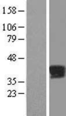 Western Blot: PPP2R4 Overexpression Lysate (Adult Normal) [NBP2-06562] Left-Empty vector transfected control cell lysate (HEK293 cell lysate); Right -Over-expression Lysate for PPP2R4.
