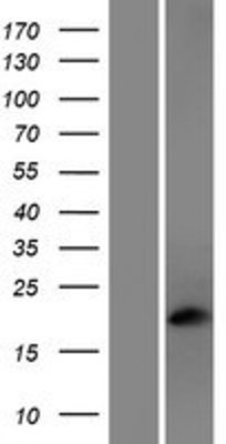 Western Blot: Phosducin Overexpression Lysate (Adult Normal) [NBP2-06421] Left-Empty vector transfected control cell lysate (HEK293 cell lysate); Right -Over-expression Lysate for Phosducin.