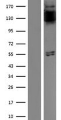 Western Blot: FGFR1 Overexpression Lysate (Adult Normal) [NBP2-07127] Left-Empty vector transfected control cell lysate (HEK293 cell lysate); Right -Over-expression Lysate for FGFR1.