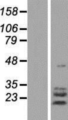 Western Blot: TPPP3 Overexpression Lysate (Adult Normal) [NBP2-07085] Left-Empty vector transfected control cell lysate (HEK293 cell lysate); Right -Over-expression Lysate for TPPP3.