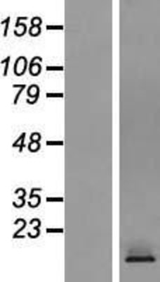 Western Blot: CRTAM Overexpression Lysate (Adult Normal) [NBP2-06714] Left-Empty vector transfected control cell lysate (HEK293 cell lysate); Right -Over-expression Lysate for CRTAM.