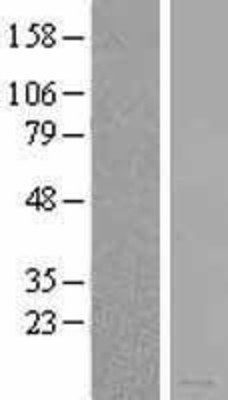 Western Blot: MIA Overexpression Lysate (Adult Normal) [NBL1-13096] Left-Empty vector transfected control cell lysate (HEK293 cell lysate); Right -Over-expression Lysate for MIA.