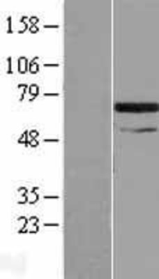 Western Blot: SNX33 Overexpression Lysate (Adult Normal) [NBL1-16316] Left-Empty vector transfected control cell lysate (HEK293 cell lysate); Right -Over-expression Lysate for SNX33.