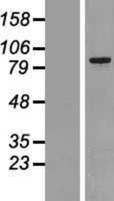 Western Blot: MARK2 Overexpression Lysate (Adult Normal) [NBP2-06979] Left-Empty vector transfected control cell lysate (HEK293 cell lysate); Right -Over-expression Lysate for MARK2.